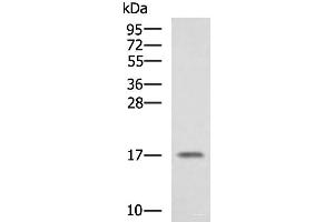 Western blot analysis of A375 cell lysate using SRP14 Polyclonal Antibody at dilution of 1:1350 (SRP14 anticorps)
