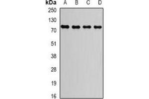 Western blot analysis of GGA2 expression in HepG2 (A), Raji (B), MCF7 (C), mouse brain (D) whole cell lysates. (GGA2 anticorps)