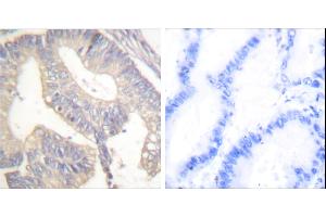 Peptide - +Immunohistochemical analysis of paraffin-embedded human colon carcinoma tissue using Gastrin antibody (#C0205). (Gastrin anticorps)