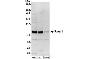 anti-Ribonucleoprotein, PTB-Binding 1 (RAVER1) (AA 556-606) antibody