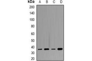 Western blot analysis of Tropomyosin expression in SW480 (A), MCF7 (B), mouse heart (C), mouse brain (D) whole cell lysates. (Tropomyosin anticorps)