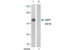 Western blot analysis of extract from mouse brain tissue, using MAPT (phospho S214) polyclonal antibody . (MAPT anticorps  (pSer214))