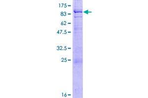 Image no. 1 for Recombination Activating Gene 2 (RAG2) protein (GST tag) (ABIN1317321)