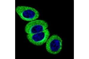 Confocal immunofluorescent analysis of phospho-ATM antibody with HeLa cells followed by Alexa Fluor 488-conjugated goat anti-rabbit lgG (green).