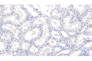 Detection of PSME3 in Human Kidney Tissue using Polyclonal Antibody to Proteasome Activator Subunit 3 (PSME3)