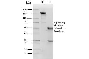 SDS-PAGE Analysis Purified p57 Monoclonal Antibody (KP10). (CDKN1C anticorps)