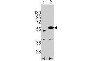 Western blot analysis of SPRED1 polyclonal antibody  (arrow). (SPRED1 anticorps  (C-Term))