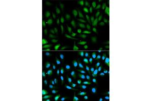 Immunofluorescence analysis of HeLa cell using PARK7 antibody.