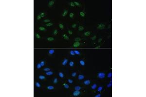Immunofluorescence analysis of U-2 OS cells using DDX50 antibody (ABIN6129371, ABIN6139509, ABIN6139510 and ABIN6224730) at dilution of 1:100. (DDX50 anticorps  (AA 1-135))