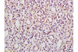 Formalin-fixed and paraffin embedded rat kidney labeled with Rabbit Anti ACVR1B/ALK4 Polyclonal Antibody, Unconjugated (ABIN761231) at 1:200 followed by conjugation to the secondary antibody and DAB staining