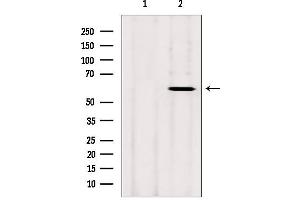 Western blot analysis of extracts from rat heart, using CYP26B1 antibody.