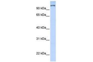 Image no. 1 for anti-Poly (ADP-Ribose) Polymerase Family, Member 9 (PARP9) (AA 144-193) antibody (ABIN6740354) (PARP9 anticorps  (AA 144-193))