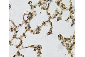 Immunohistochemistry of paraffin-embedded Rat lung using IFI16 Polyclonal Antibody at dilution of 1:100 (40x lens).