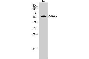Western Blotting (WB) image for anti-Cytochrome P450, Family 3, Subfamily A, Polypeptide 4 (CYP3A4) (Internal Region) antibody (ABIN3184195) (CYP3A4 anticorps  (Internal Region))