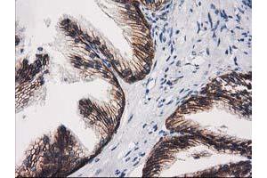 Image no. 2 for anti-Catenin (Cadherin-Associated Protein), beta 1, 88kDa (CTNNB1) antibody (ABIN1496893)