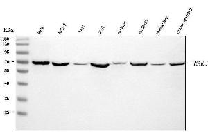 Western blot analysis of RARS/RARS1 using anti-RARS/RARS1 antibody (ABIN7600223). (Probable Arginine--tRNA Ligase, Cytoplasmic (RARS-1) (AA 165-425) anticorps)