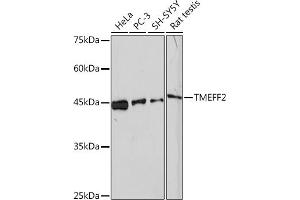 Western blot analysis of extracts of various cell lines, using TMEFF2 Rabbit mAb (ABIN1682727, ABIN3018560, ABIN3018561 and ABIN7101627) at 1:1000 dilution.