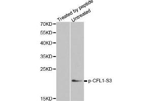 Western blot analysis of extracts from COLO205 cells, using phospho-CFL1-S3 antibody.