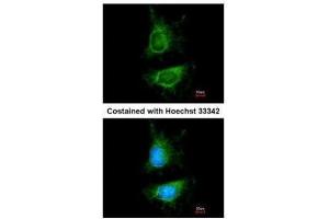 ICC/IF Image Immunofluorescence analysis of paraformaldehyde-fixed HeLa, using MDM2, antibody at 1:200 dilution.