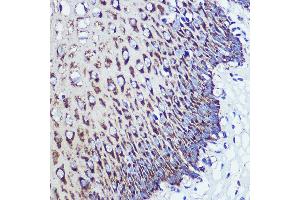 Immunohistochemistry of paraffin-embedded Human esophageal using OSBPL8 Rabbit pAb (ABIN7269139) at dilution of 1:100 (40x lens).