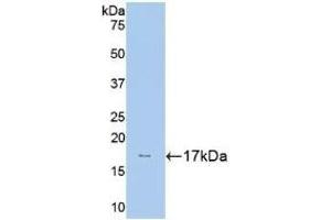 Detection of Recombinant HK1, Human using Polyclonal Antibody to Hexokinase 1 (HK1) (Hexokinase 1 anticorps  (AA 80-215))