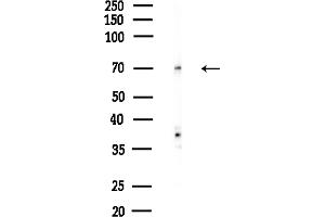 Western blot analysis of lysates from Hela cells(heat-shock,45 min treatment), using SNX9 Antibody at 1/1000 dilution.