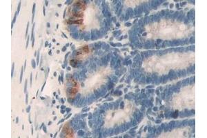 Detection of DLD in Rat Small intestine Tissue using Polyclonal Antibody to Dihydrolipoyl Dehydrogenase (DLD) (DLD anticorps)