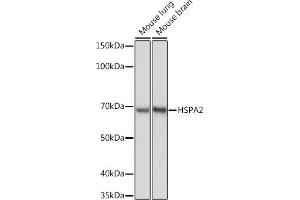 Western blot analysis of extracts of various cell lines, using HSP Rabbit mAb (ABIN7267579) at 1:1000 dilution. (HSPA2 anticorps)