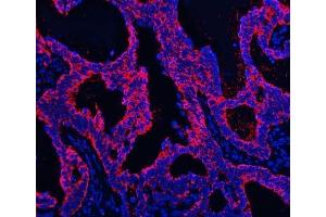 anti-Transmembrane Protease, Serine 13 (TMPRSS13) (AA 118-572) antibody