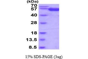 SDS-PAGE (SDS) image for Interleukin 18 Binding Protein (IL18BP) (AA 31-194) protein (hIgG-His-tag) (ABIN5854726)