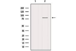 Western blot analysis of extracts from Mouse lung, using MECP2 Antibody.