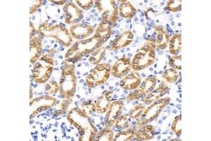 Immunohistochemistry analysis of paraffin-embedded rat duodenum using,STC (ABIN7075723) at dilution of 1: 800