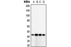 Western blot analysis of TUSC3 expression in SKBR3 (A), HeLa (B), HepG2 (C), MDAMB231 (D) whole cell lysates.