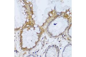 Immunohistochemistry of paraffin-embedded human stomach using GCC2 antibody (ABIN6130422, ABIN6141007, ABIN6141008 and ABIN6217941) at dilution of 1:150 (40x lens). (GCC2 anticorps  (AA 1-300))
