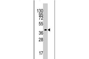Western blot analysis of TBRG1 polyclonal antibody  in mouse kidney tissue lysates (35 ug/lane).