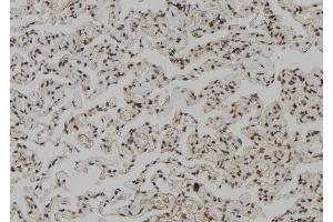 ABIN6267147 at 1/100 staining Human lung tissue by IHC-P.