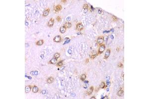 Immunohistochemistry of paraffin-embedded rat brain using RPS3A Antibody. (RPS3A anticorps  (AA 1-264))