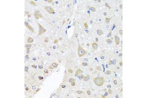 Immunohistochemistry of paraffin-embedded rat brain using EIF3M antibody at dilution of 1:100 (x40 lens). (Eukaryotic Translation Initiation Factor 3, Subunit M (EIF3M) anticorps)