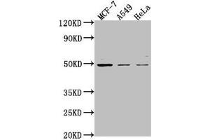 Western Blot Positive WB detected in: MCF-7 whole cell lysate, A549 whole cell lysate, Hela whole cell lysate All lanes: TSKU antibody at 1:2000 Secondary Goat polyclonal to rabbit IgG at 1/50000 dilution Predicted band size: 38 kDa Observed band size: 49 kDa (TSKU anticorps  (AA 77-353))