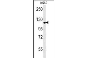 POTEE Antibody (Center) (ABIN653968 and ABIN2843918) western blot analysis in K562 cell line lysates (35 μg/lane).