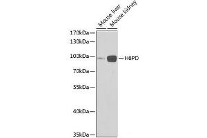 Western blot analysis of extracts of various cell lines using H6PD Polyclonal Antibody at dilution of 1:1000. (Glucose-6-Phosphate Dehydrogenase anticorps)