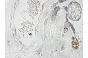Image no. 1 for anti-Interleukin 15 (IL15) antibody (ABIN464931) (IL-15 anticorps)