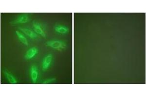 Immunofluorescence analysis of HeLa cells, using Keratin 18 Antibody. (Cytokeratin 18 anticorps  (AA 381-430))