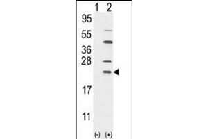 Western blot analysis of UBE2C (arrow) using rabbit polyclonal UBE2C Antibody (N-term G25) (ABIN388856 and ABIN2839158). (UBE2C anticorps  (N-Term))