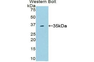Western Blotting (WB) image for anti-Signal Transducer and Activator of Transcription 6, Interleukin-4 Induced (STAT6) (AA 557-841) antibody (ABIN3206147) (STAT6 anticorps  (AA 557-841))