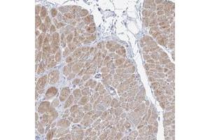 Immunohistochemical staining of human heart muscle with FAM184A polyclonal antibody  shows moderate cytoplasmic positivity in myocytes at 1:200-1:500 dilution. (FAM184A anticorps)