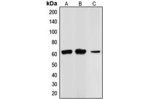 Western blot analysis of CHK2 expression in Jurkat (A), HL60 (B), HT29 (C) whole cell lysates.