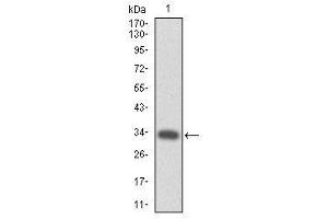 Image no. 2 for anti-Myeloproliferative Leukemia Virus Oncogene (MPL) antibody (ABIN1497161)