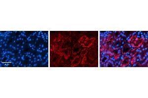 Rabbit Anti-AQP2 Antibody   Formalin Fixed Paraffin Embedded Tissue: Human Kidney Tissue Observed Staining: Cytoplasm Primary Antibody Concentration: 1:100 Other Working Concentrations: 1:600 Secondary Antibody: Donkey anti-Rabbit-Cy3 Secondary Antibody Concentration: 1:200 Magnification: 20X Exposure Time: 0. (AQP2 anticorps  (Middle Region))