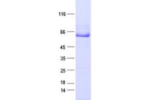 Validation with Western Blot